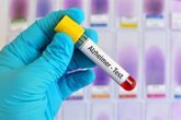 Foto: Un análisis de sangre para detectar el Alzheimer podría no funcionar igual en todo el mundo