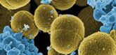 Foto: El CSIC desarrolla nuevos materiales antimicrobianos para prevenir infecciones sin favorecer resistencias