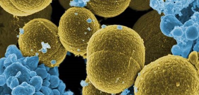 A bactéria “Staphylococcus aureus” escapando da destruição pelas células brancas humanas.