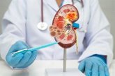 Foto: Crece la enfermedad renal crónica entre las mujeres y agrava el riesgo cardiovascular