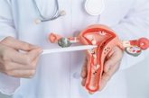 Foto: Identifican nuevas dianas terapéuticas para desarrollar tratamientos más precisos contra el cáncer de cuello uterino