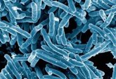 Foto: Descubren que un gen ya conocido de la tuberculosis se activa bajo estrés