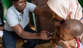 Foto: UNICEF alerta de la elevada presencia de menores entre los casos sospechosos del primer brote de mpox en Guinea-Bissau