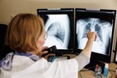 Foto: La Junta confirma tuberculosis en dos trabajadores de una explotación en Segovia, uno de los cuales ha fallecido