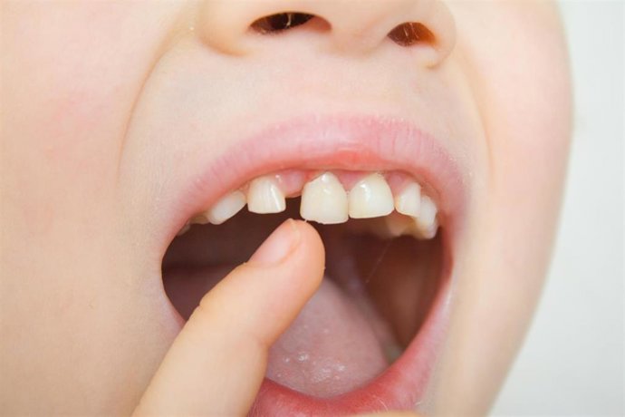 Archivo - Imagen de recurso de un niño que se señala el diente.