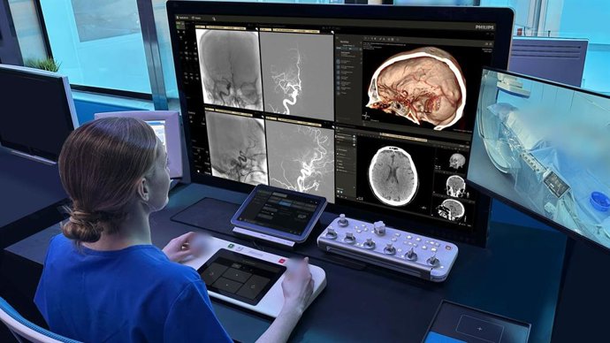 Philips, seleccionada por ARPA-H para impulsar la robótica y la IA en la atención al ictus
