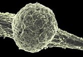 Foto: Uganda declara el final del brote de ébola tras 42 días sin contagios tras el alta del último paciente