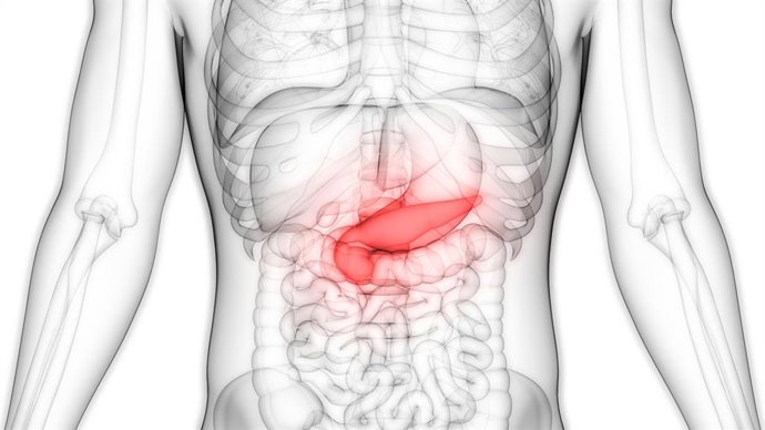 Archivo - Una investigación concluye que la diabetes tipo 2 se manifiesta de manera diferente según el peso corporal
