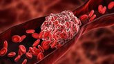 Foto: La SEACVE critica un documento de SERVEI, SEMERGEN y SEMG al considerar que puede fragmentar la atención vascular
