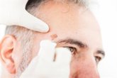 Foto: El Hospital Germans Trias trata lesiones de cáncer de piel sin cirugía con una resina radiactiva