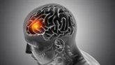 Foto: Hallán alteraciones tempranas del lenguaje narrativo en pacientes con Parkinson