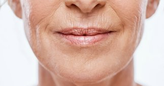 Estética