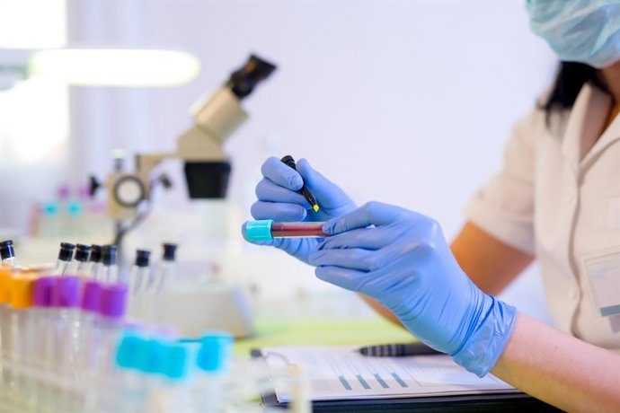 Archivo - Arquivo - Exame de sangue, marcadores tumorais, mulher trabalhando em um laboratório