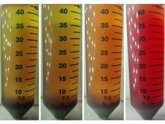 Foto: Un nuevo método podría reducir el tiempo de diagnóstico de la sepsis de días a horas