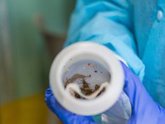 Foto: Desarrollan un sistema con IA para detectar la enfermedad de Chagas en tiempo real en el móvil
