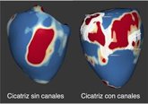 Foto: Identifican nuevos marcadores para mejorar el riesgo de arritmias ventriculares graves