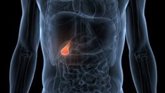 Foto: Demuestran que la biopsia líquida sirve para personalizar tratamientos en cáncer de vías biliares