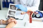 Foto: ¿Un mioma uterino puede convertirse en cáncer? Una ginecóloga aclara una de las grandes dudas tras el diagnóstico
