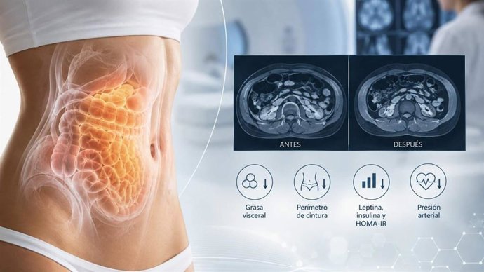 Capenergy Medical demuestra la reducción de grasa visceral con tecnología no invasiva