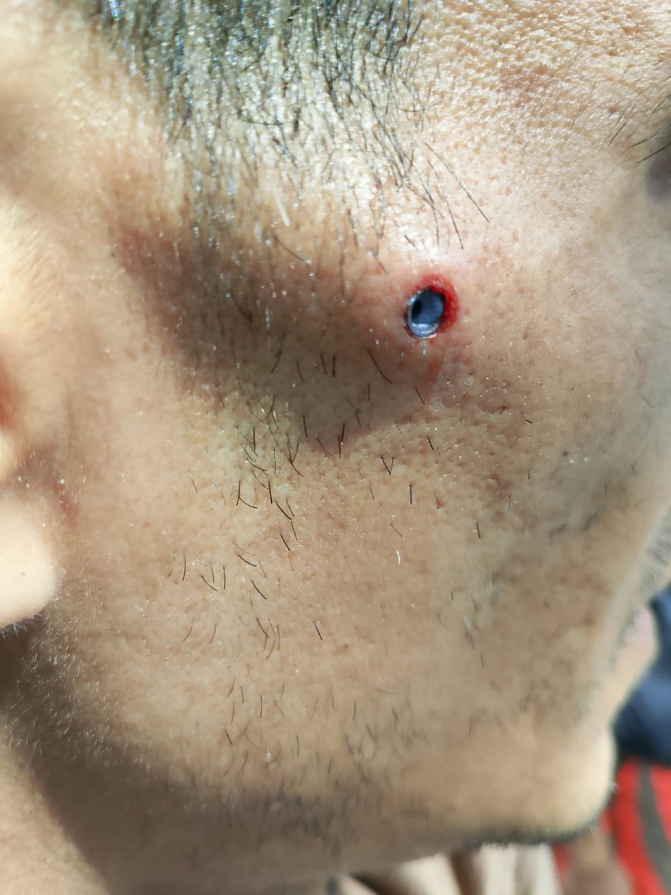 Denuncian la agresión a una persona migrante con un arma de aire comprimido en San Sebastián