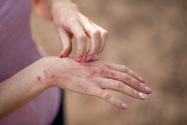 Foto: IRINA ESAU/ ISTOCK - Archivo