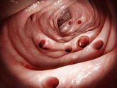 Foto: Divertículos: los alimentos que sí puedes comer y el mito de los frutos secos y las semillas