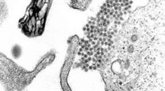 Foto: Identifican cómo el dengue debilita temporalmente la barrera vascular