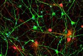 Foto: Alzheimer: una proteína aumenta en el cerebro y el líquido cefalorraquídeo de los pacientes