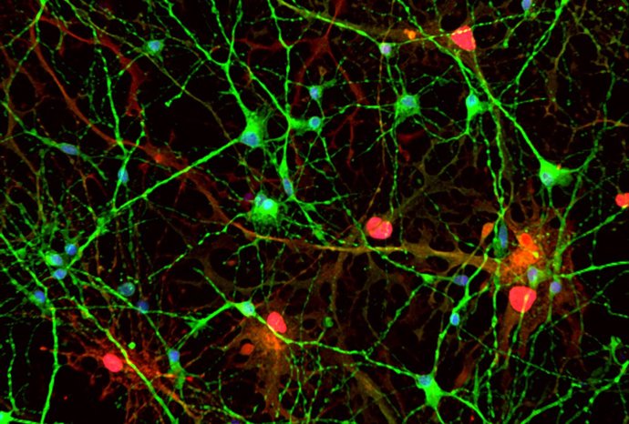 Imagen de un cultivo celular de células madre pluripotentes inducidas (iPSC) con las neuronas marcadas en verde y los astrocitos en rojo