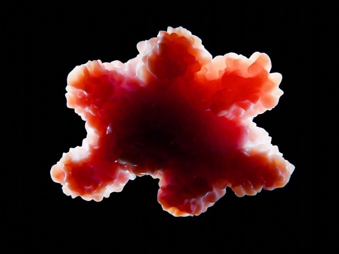Un estudio con organoides revela propiedades inesperadas en los márgenes tumorales de cáncer de mama multicéntrico