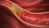 Foto: La Sociedad Española de Arteriosclerosis destaca la necesidad de identificar la hipercolesterolemia familiar en niños