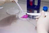 Foto: El implante de condrocitos autólogos de alta densidad mantiene supervivencia del 97,5% en lesión de cartílago de rodilla