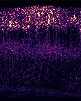 Imagen de la corteza somatosensorial de un ratón, con neuronas de las capas superficiales y sus cuerpos celulares, dendritas y prolongaciones axonales. Ilustra el papel de GluN3A en la organización de estas conexiones durante el desarrollo cerebral.
