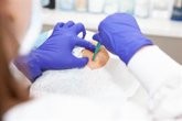 Foto: ¿Por qué tarda tanto el resultado de una biopsia? Esto es lo que ocurre en el laboratorio