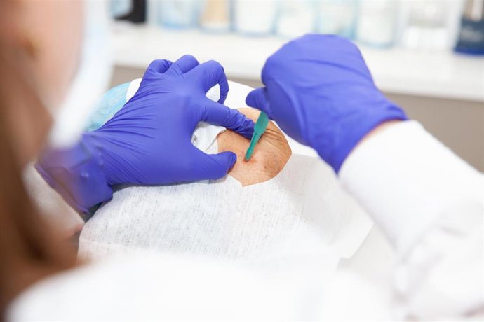 Archivo - Dermatólogo que realiza una biopsia de piel en el rostro de un paciente adulto mayor. Procedimiento de extirpación de lesiones cutáneas. Punzón de biopsia.