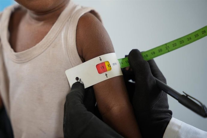Archivo - Un trabajador sanitario realiza una prueba sobre desnutrición a un niño en una clínica apoyada por el Fondo de Naciones Unidas para la Infancia (UNICEF) en Adén, Yemen
