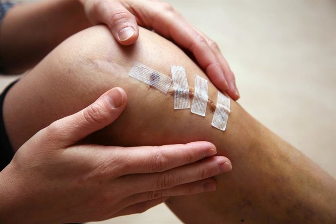Archivo - Lesión de rodilla, ligamento cruzado anterior.