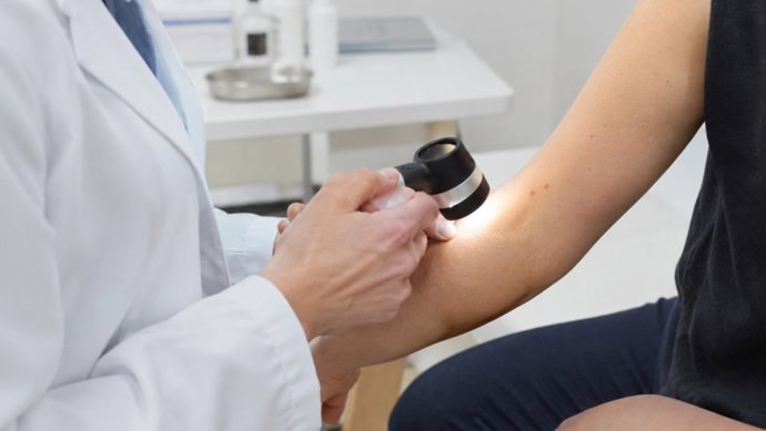 Consulta de Dermatología