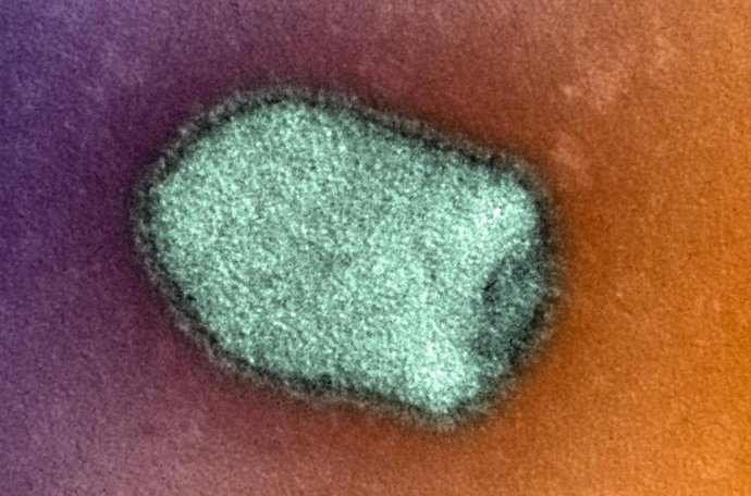 Archivo - Imagen del virus de la rabia.