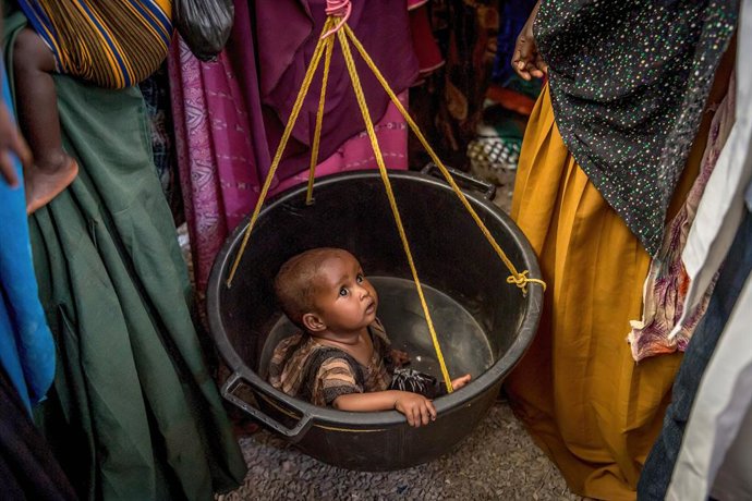 Archivo - December 19, 2022, Mogadishu, Somalia: A child is being screened for malnutrition at a health clinic in Baidoa. The Horn of African country is suffering from its worst drought in decades, with millions of Somalis in need of food, aid and humanit