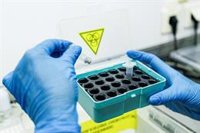 La agencia de salud pública de EEUU "sigue de cerca" el supuesto caso de peste pulmonar en Rusia