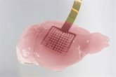 Foto: Una nueva tecnología de grafeno ofrece información en tiempo real sobre la vulnerabilidad neuronal tras un ictus