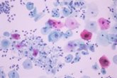 Foto: La UAH y el Príncipe de Asturias desarrollan un sistema de IA para detectar la tricomoniasis