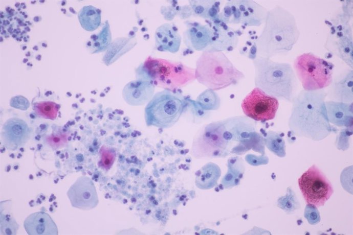 Trichomonas vaginalis, um dos microrganismos responsáveis pela infecção de transmissão sexual (ITS) não viral mais comum no mundo, a tricomoníase