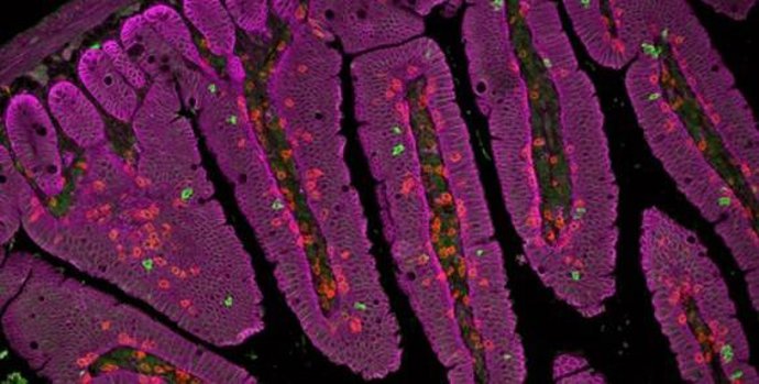 Imagen de microscopía que muestra las células T gamma-delta (verde) patrullando el intestino (rosa)