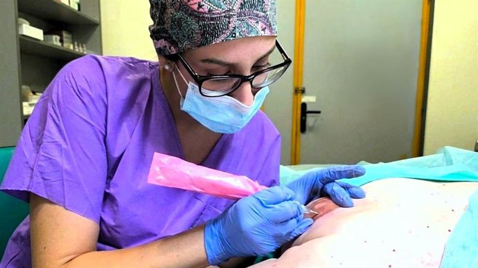 La restauración del complejo areola-pezón en pacientes con cáncer de mama favorece su salud emocional y su autoestima.