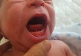 Foto: Expertos advierten de que el frenillo lingual corto puede influir en los problemas respiratorios del sueño infantil