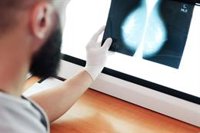 La inteligencia artificial permite calcular el riesgo de cáncer de mama a cinco años a partir de una sola mamografía