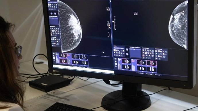 Fundación Rioja Salud incorpora un nuevo mamógrafo en la Unidad de Mama para mejor diagnóstico y detección precoz