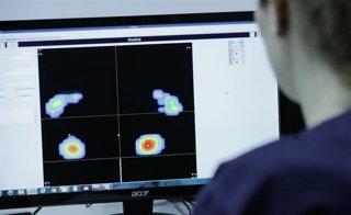 Análisis del estudio de la pisada